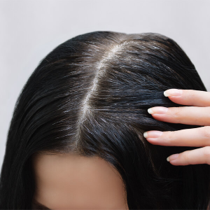 Premature Greying